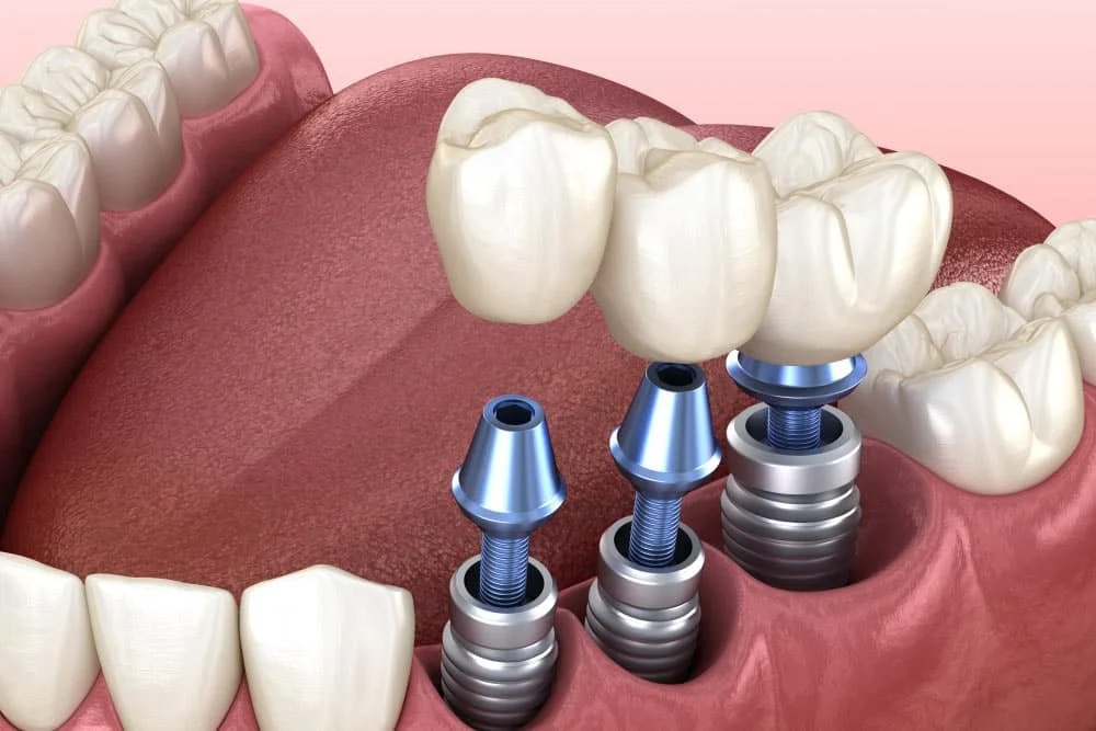 Orthodontics